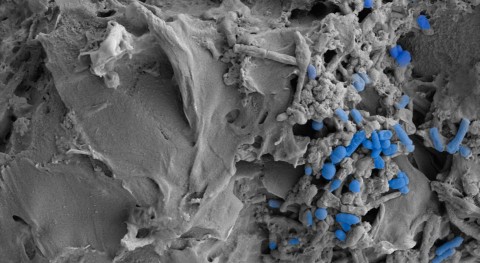 estudio demuestra que ingesta microplásticos altera microbiota intestinal